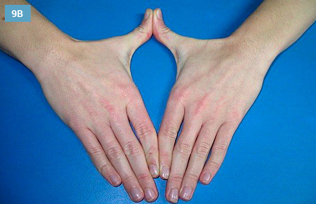 Ćwiczenie rozciągania przyśrodkowych części rąk